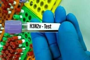 Influenza par kavita